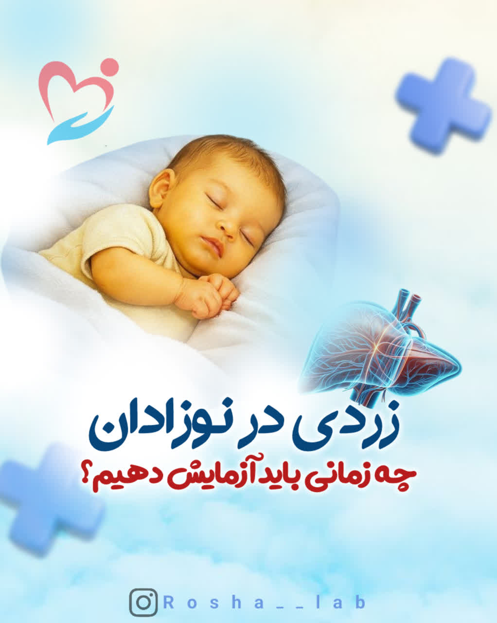 زردی در نوزادان