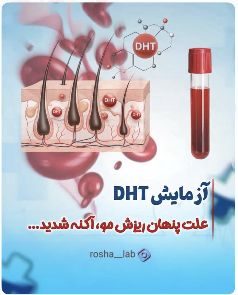 آزمایش DHT(Dihydro testosterone)